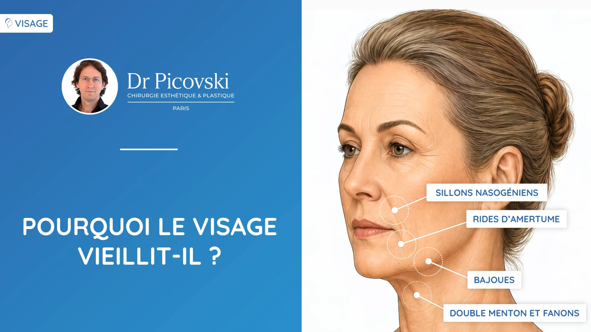 Création d'une vidéo sur le Lifting du visage pour le Dr Picovski avec l'Intelligence Artificielle
